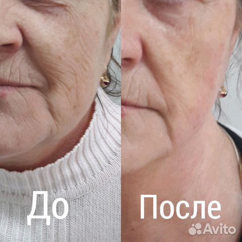 Косметолог,брови,шугаринг,ламиниров. ресниц,макияж