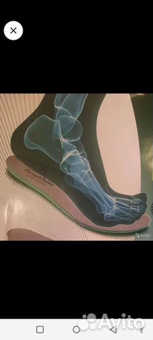 Изготовление индивидуальных ортопедических стелек