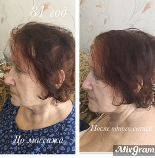 Массаж лица и тела